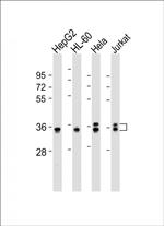 AKR7L Polyclonal Antibody
