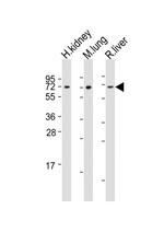 ACSF2 Polyclonal Antibody