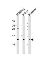 MTCP1 Polyclonal Antibody