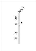 PTDSS1 Polyclonal Antibody