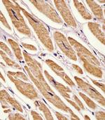 Adenylate Kinase 2 Polyclonal Antibody