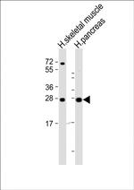 CELA2B Polyclonal Antibody
