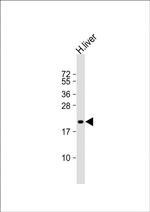 ROPN1 Polyclonal Antibody