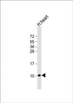 ATP5EP2 Polyclonal Antibody