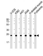 UQCRFS1P1 Polyclonal Antibody