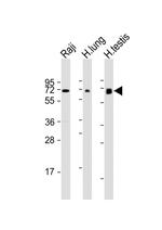 ERVK-7 Antibody in Western Blot (WB)