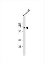 DVL1P1 Polyclonal Antibody