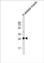 DNASE1L2 Polyclonal Antibody
