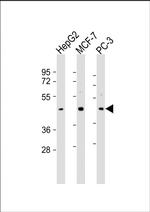 SAPCD2 Polyclonal Antibody