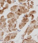Titin Antibody in Immunohistochemistry (Paraffin) (IHC (P))