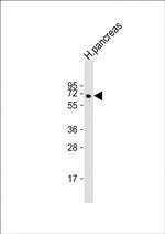 MGAT4B Polyclonal Antibody