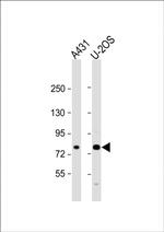 MAN1A2 Polyclonal Antibody
