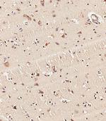 KMT2D Antibody in Immunohistochemistry (Paraffin) (IHC (P))