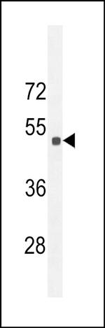 SESN2 Polyclonal Antibody
