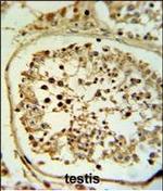 Fascin-3 Polyclonal Antibody