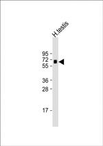 Fascin-3 Antibody in Western Blot (WB)