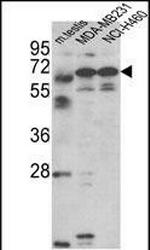 Fascin-3 Antibody in Western Blot (WB)
