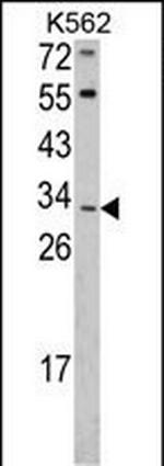 ITM2A Antibody in Western Blot (WB)