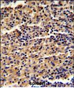 ALKBH8 Polyclonal Antibody