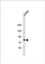 ALKBH8 Antibody in Western Blot (WB)