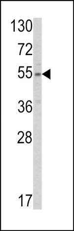 SLC38A3 Polyclonal Antibody