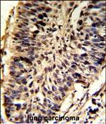 SNRPD2 Polyclonal Antibody