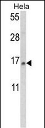 SNRPD2 Antibody in Western Blot (WB)