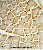 PI4KB Polyclonal Antibody