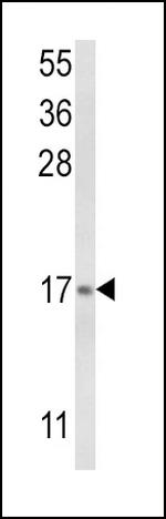 LTC4S Polyclonal Antibody