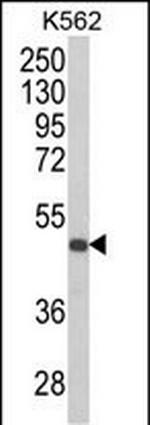 KIR3DS1 Polyclonal Antibody