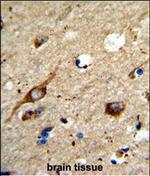 AGPAT3 Polyclonal Antibody