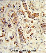 NCF1C Polyclonal Antibody
