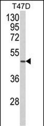 NCF1C Antibody in Western Blot (WB)