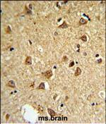 DIO2 Polyclonal Antibody