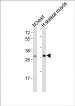 DIO2 Antibody in Western Blot (WB)