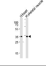 DIO2 Antibody in Western Blot (WB)