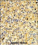CCDC3 Polyclonal Antibody