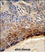 CTHRC1 Polyclonal Antibody