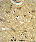 UBAP1 Polyclonal Antibody