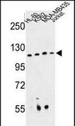 RPGRIP1 Antibody in Western Blot (WB)
