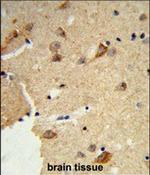 DTX4 Polyclonal Antibody