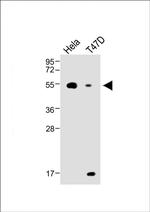 B4GALT1 Polyclonal Antibody