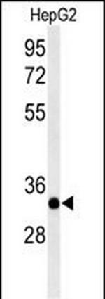 ACER3 Polyclonal Antibody