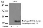 ZCCHC10 Polyclonal Antibody