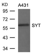 SS18 Polyclonal Antibody