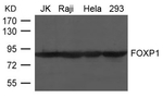 FOXP1 Polyclonal Antibody