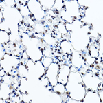 TWIST1 Antibody in Immunohistochemistry (Paraffin) (IHC (P))