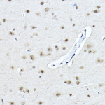 TWIST1 Antibody in Immunohistochemistry (Paraffin) (IHC (P))