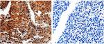 ABCB8 Antibody in Immunohistochemistry (Paraffin) (IHC (P))