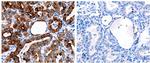 CLEC4D Polyclonal Antibody